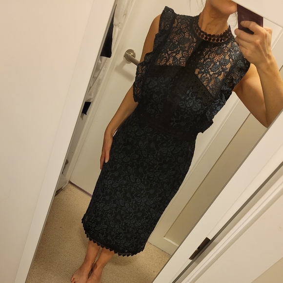 Zara Dresses & Skirts - Zara High Neck Deep Teal & Black Lace Cocktail Dress